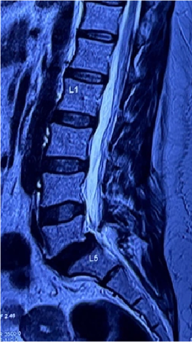 Case 1