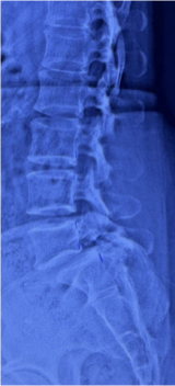 Case 1