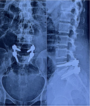 Case 1