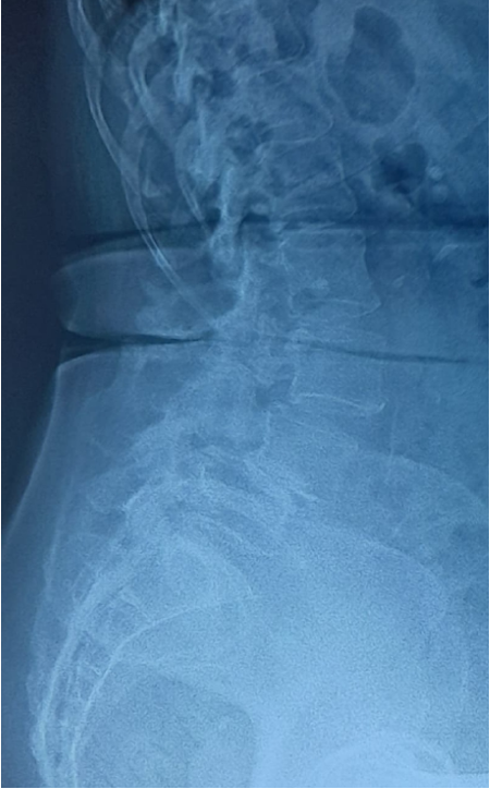 Case 2