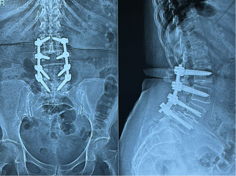 Case 2