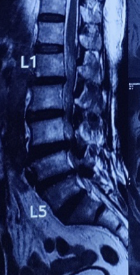Case 4