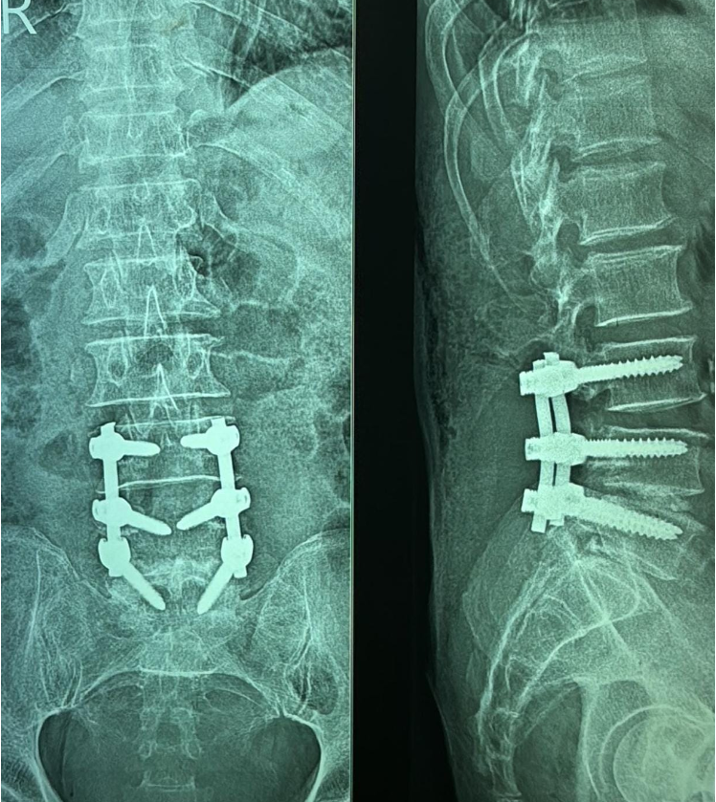 Case 4