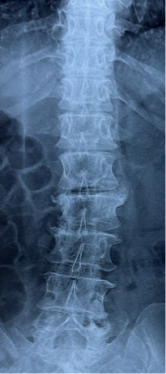 Case 5