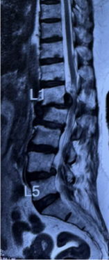 Case 5