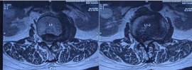Case 5