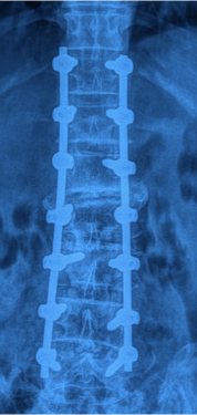 Case 5