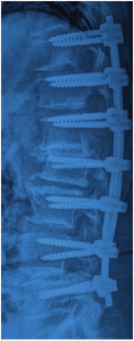 Case 5