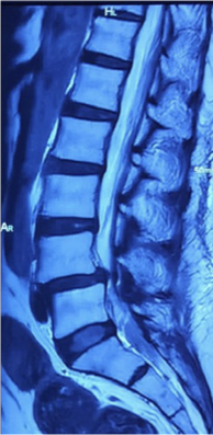 Case 6