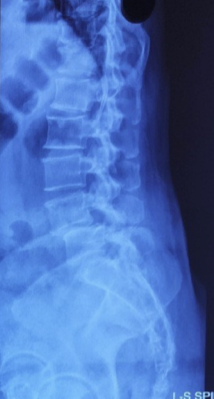 Case 6