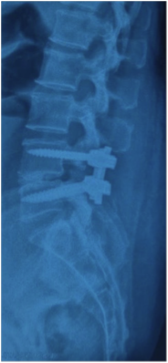 Case 6