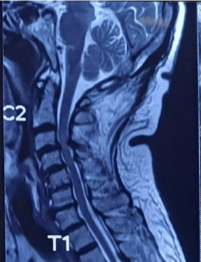 Case 1