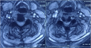 Case 1