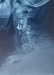 Case 1