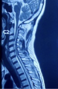 Case 2