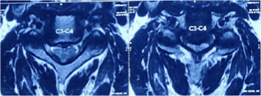 Case 2