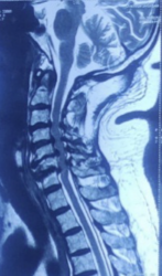 Case 4