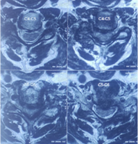 Case 4