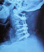 Case 4