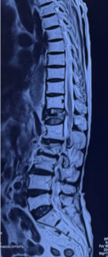 Case 1