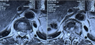Case 1