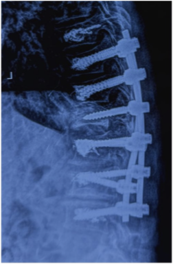 Case 1