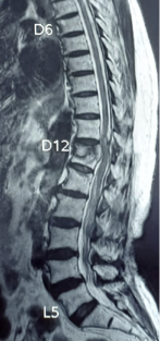 Case 2