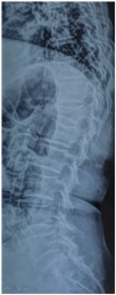 Case 2