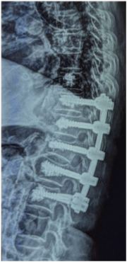 Case 2