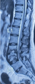 Case 1