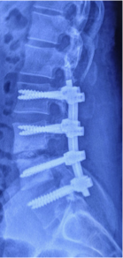 Case 1