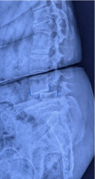 Case 1