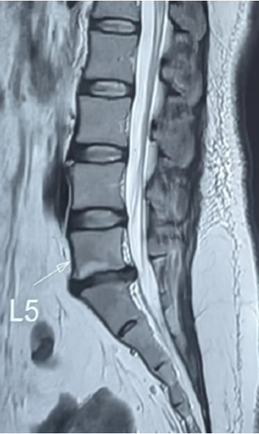 Case 2