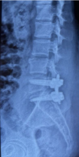 Case 2