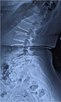 Case 4