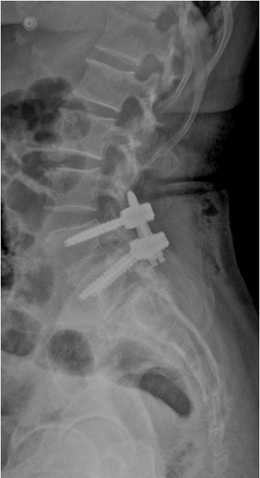 Case 4