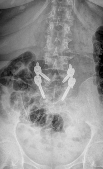 Case 4